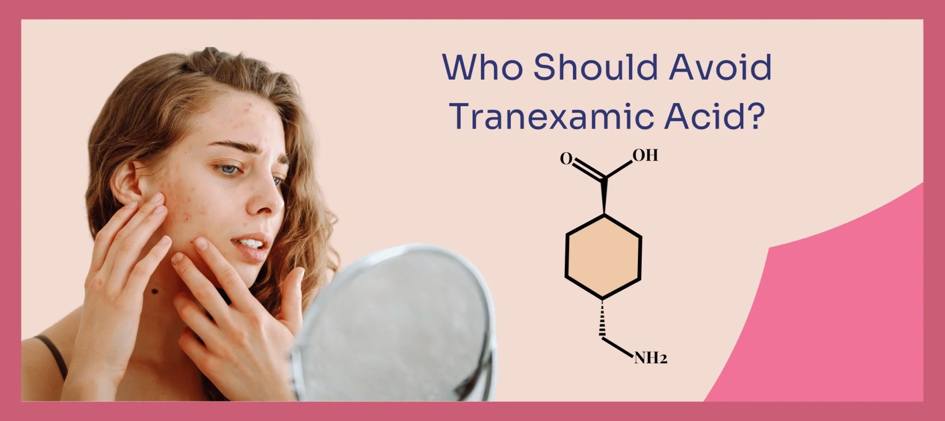 网红“氨甲环酸”被批准用于色斑治疗了吗？